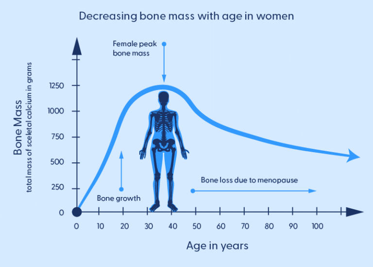 The Effects of Menopause on Joint Pain and Bone Health Understanding the Changes London