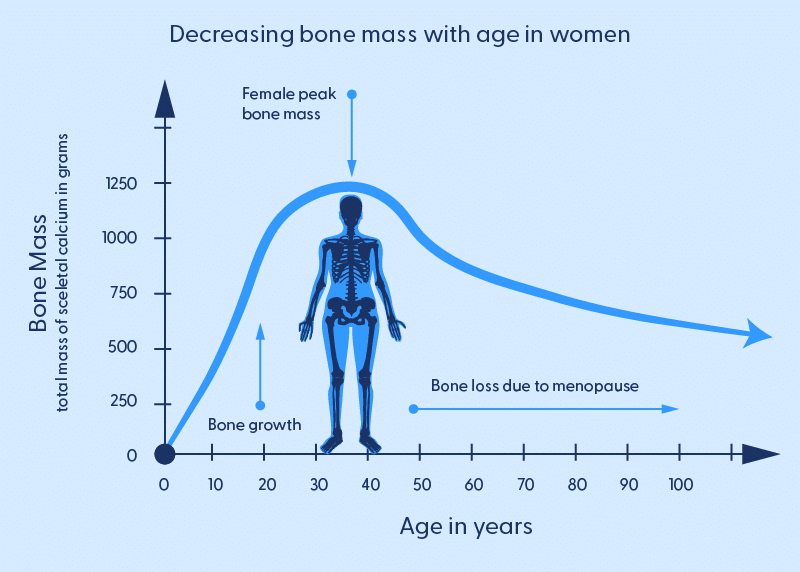 A diagram showing the typical bone mass of a woman and how it increases/decreases during a lifetime. A woman can expect her bone mass to increase from birth until around the age of 40. After the 40s, bone loss due to menopause is expected. 